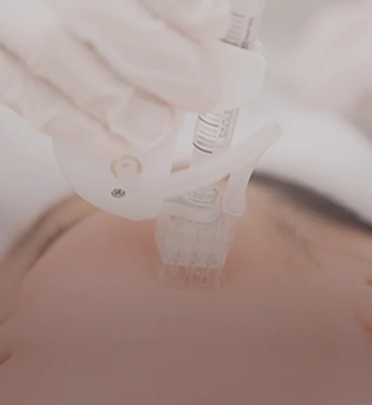 リジュラン水光注射