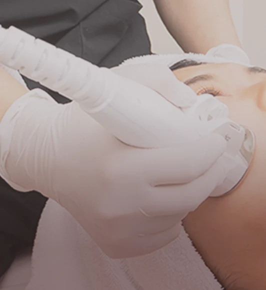 エレクトロポレーション