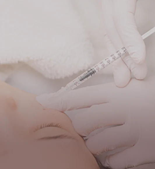 ボトックス注射